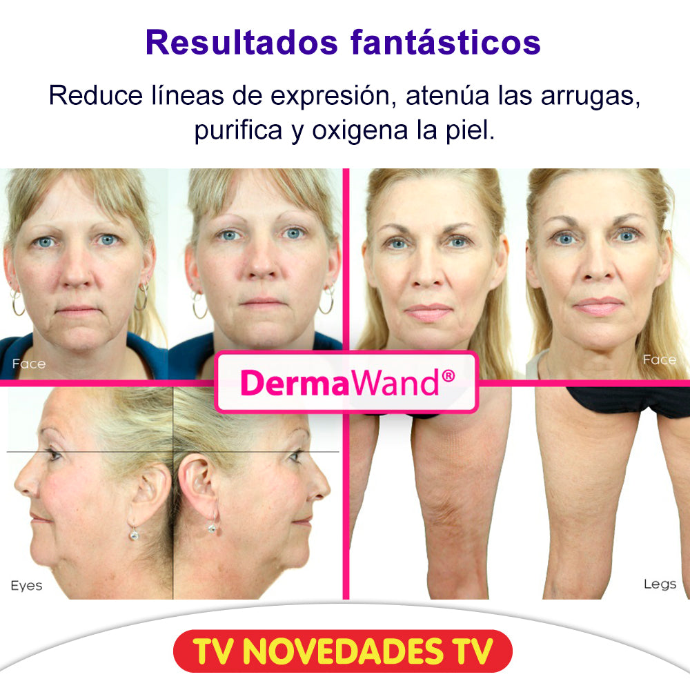 Rejuvenece la piel desde casa con DermaWand